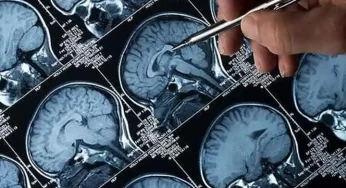Delhi hospital gets India’s first brain mapping technology