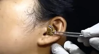 Viral video: Snake gets stuck in woman’s ear