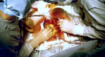 Docs at Arunachal’s lone medical college do rare heart surgery